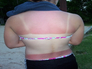itsunscreen.jpg